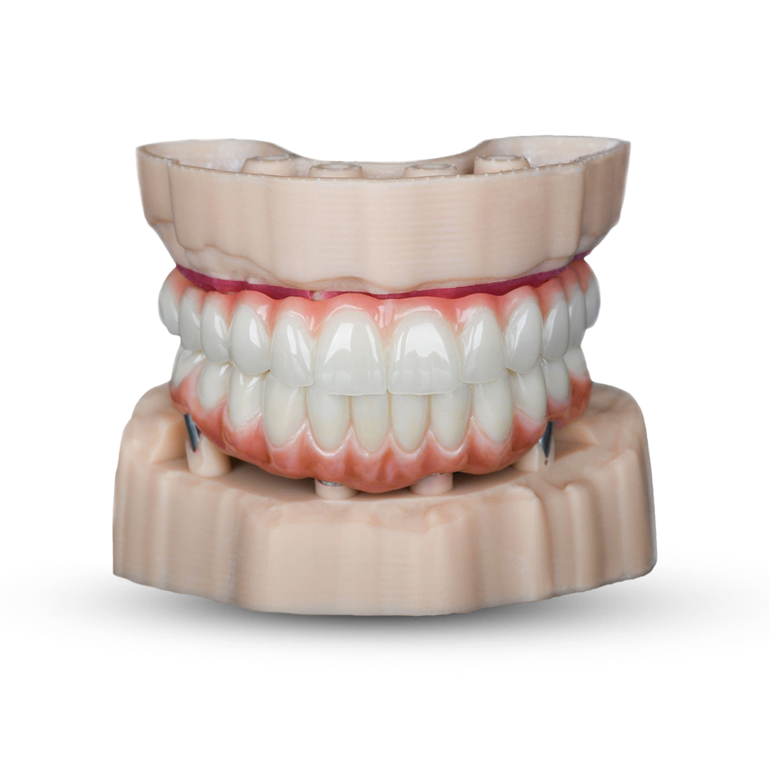 Full mouth dental implant package model UK